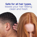 Head & Shoulders BARE Soothing Hydration Dandruff Shampoo, Anti-Dandruff, 13.5 oz